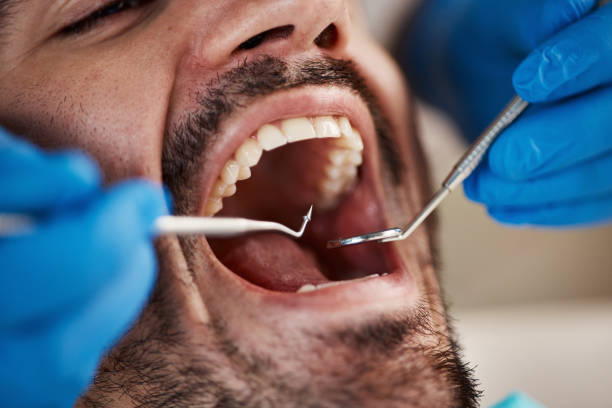 Best Emergency Dental Care for Abscessed Tooth in Lennox, SD